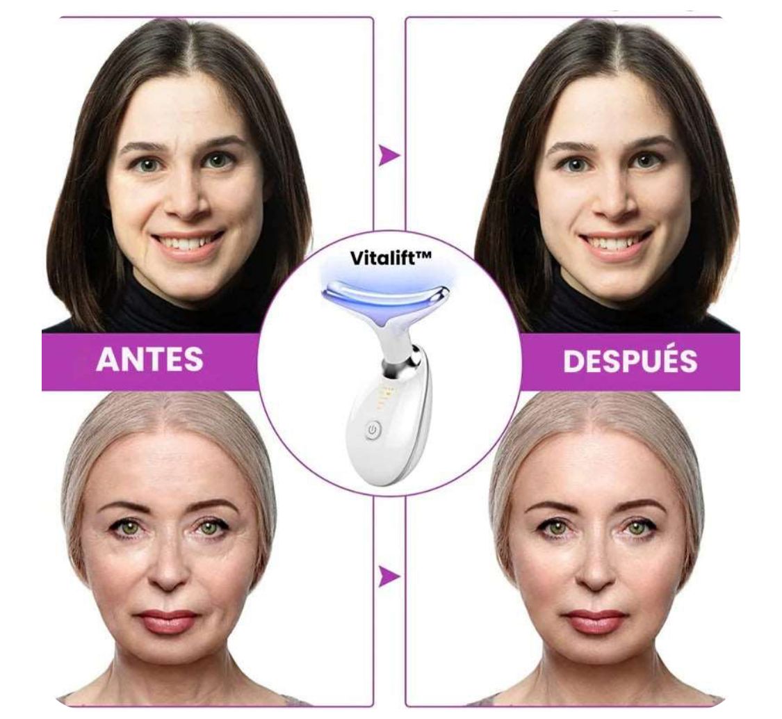 Reductor de Papada y Arrugas Eléctrico | Lifting Facial desde Casa