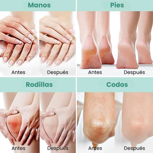 CREMA UREA AL 40% - MANOS Y PIES
